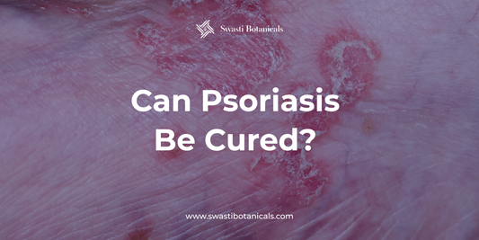 Can Psoriasis Be Cured? The Honest Medical Answer