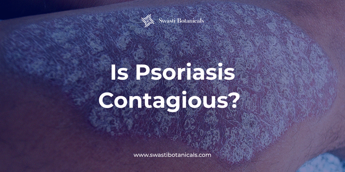 Is Psoriasis Contagious? The Definitive Answer