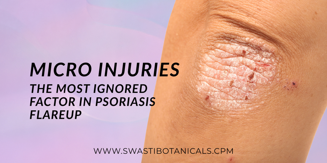Micro Injuries: The Most Ignored Factor in Psoriasis Flareup