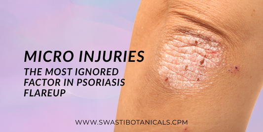 Micro Injuries: The Most Ignored Factor in Psoriasis Flareup