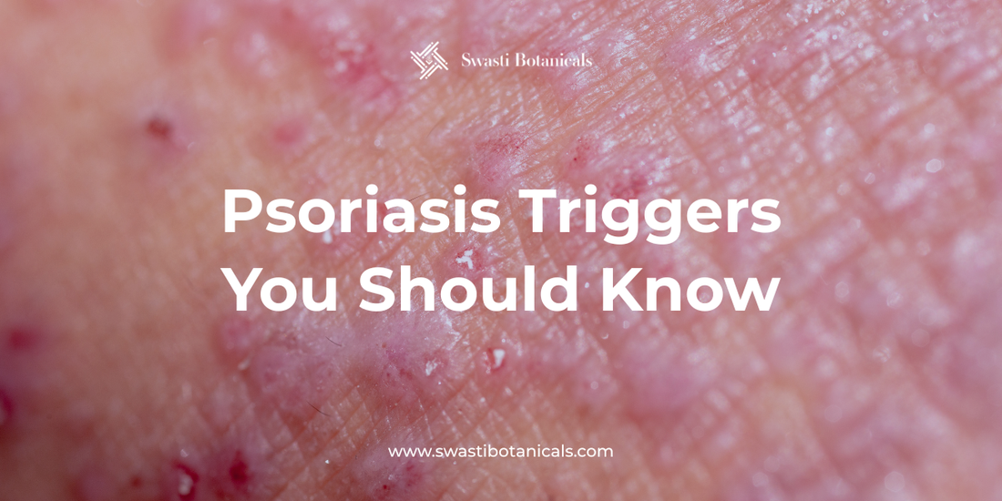 Psoriasis Triggers You Should Know — Full Guide