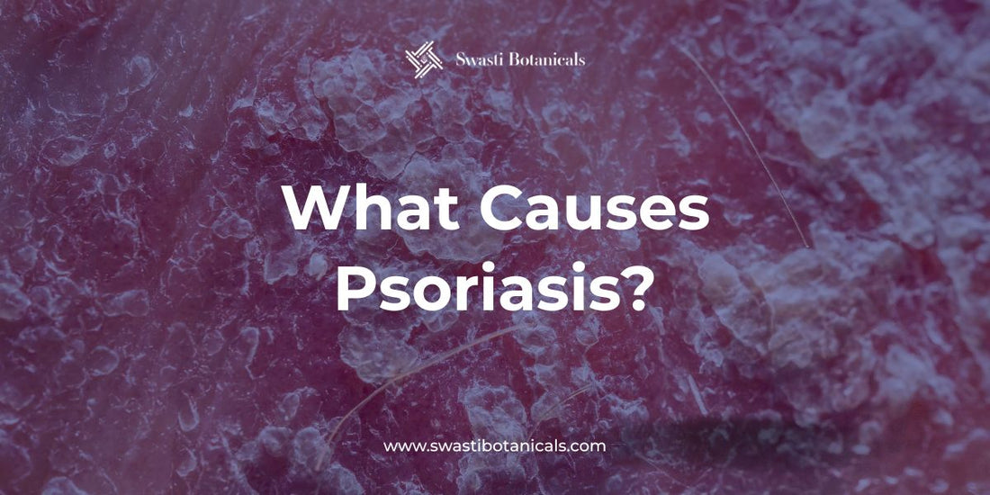 What Causes Psoriasis