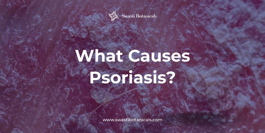 What Causes Psoriasis