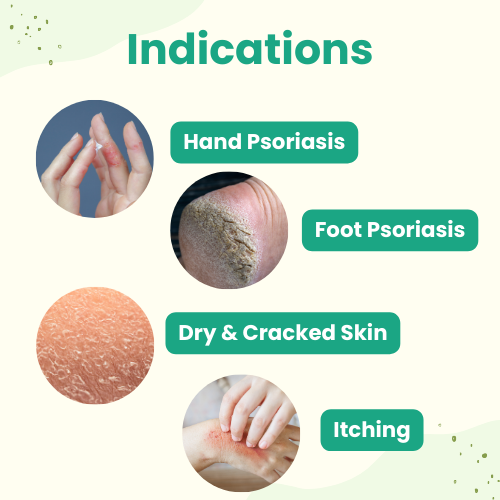 Psoriasis Cream for Hands and Feet